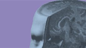 Neuroethics: the cerebral basis of justice and democracy?